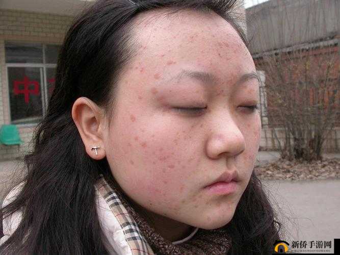 女性三角区长硬疙瘩，这是怎么回事？