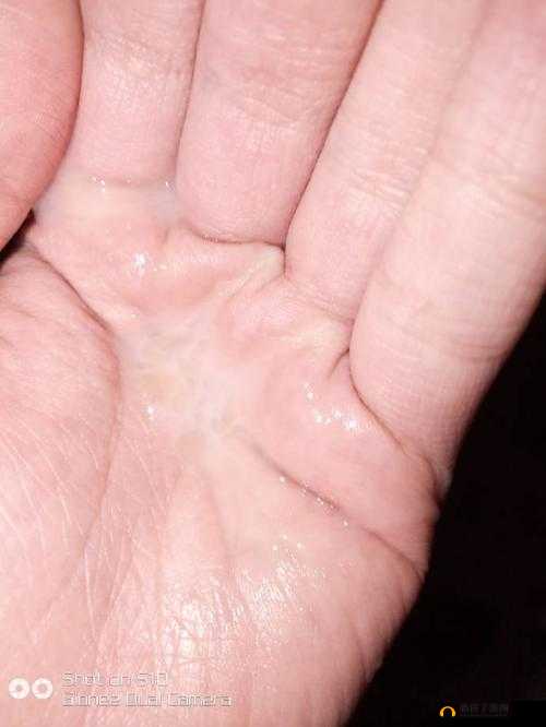 镜流口水流白色液体是否正常