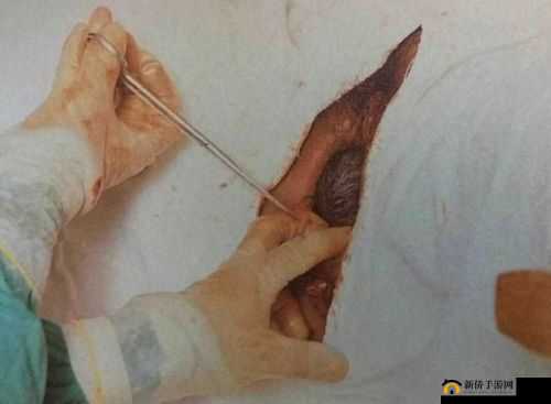 windowschannel 孕妇生产：全过程记录