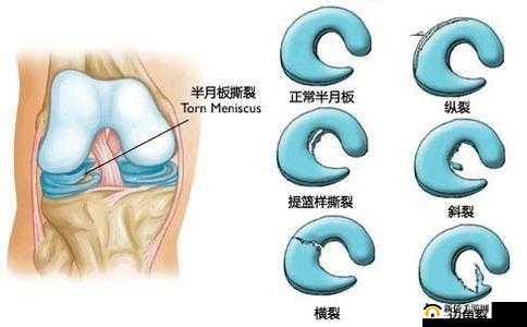 12 岁女孩阴脣外翻是怎么回事？