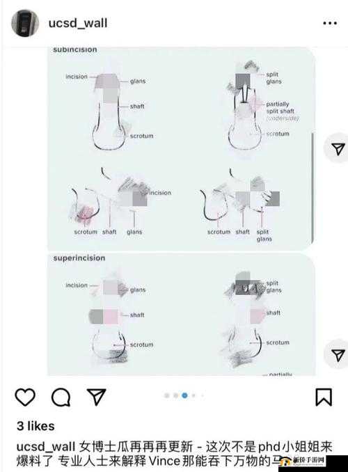 人进入羊水门最怕三种东西：探秘其缘由
