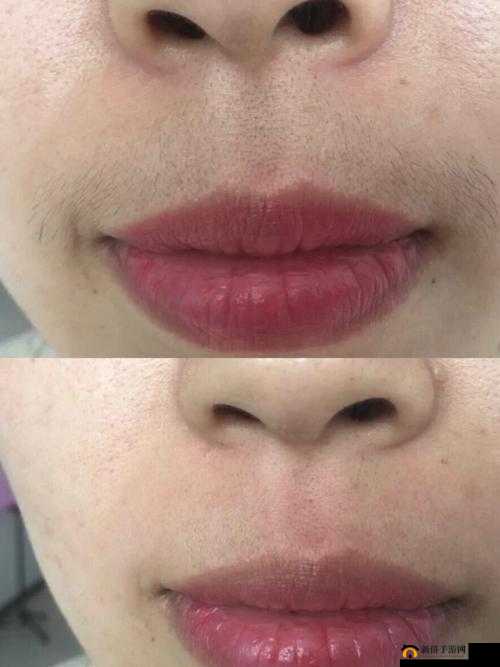 二十多岁唇毛明显，十八岁后竟奇迹消失