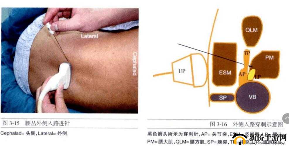 腰下一沉穿透那层膜后的感受