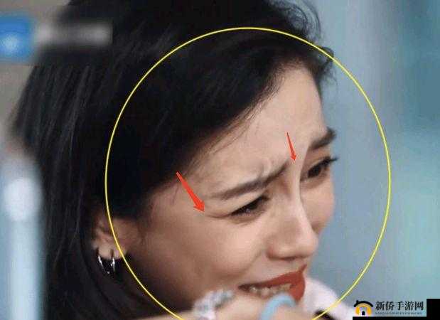 塞满嘴巴把脸撑大了能恢复吗：嘴巴被撑大后的恢复问题