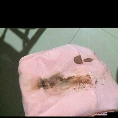 剧烈运动后下面流血咋回事