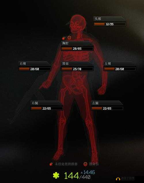 逃离塔科夫：血量揭秘，如何轻松查看