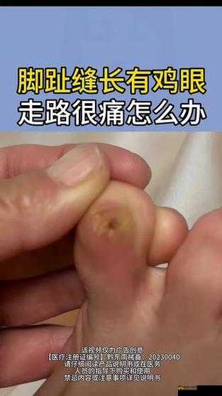 红肿疼痛且小缝无法合拢引发的困扰