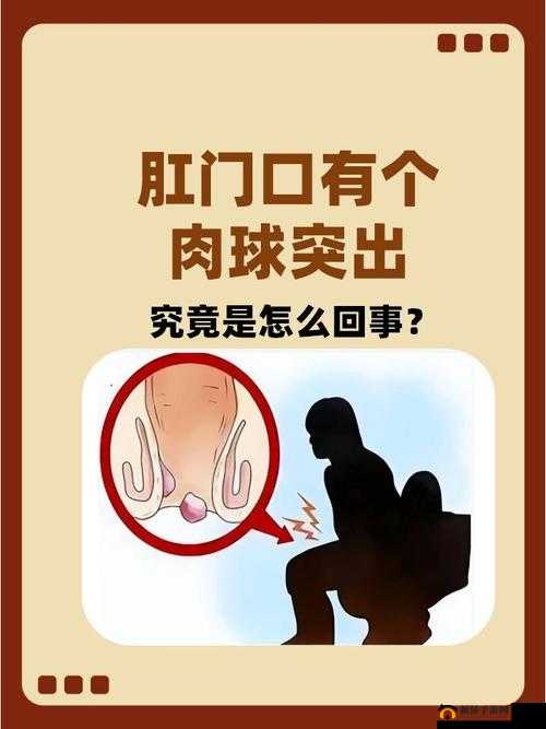 肛门口摸到个软软的肉要怎么消除：权威专家详细解析及对策